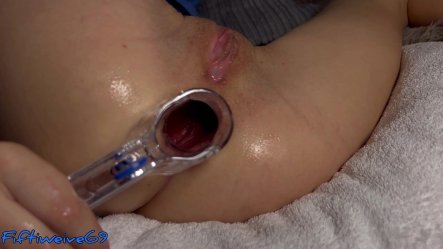 Anal dilator play, look deeper inside her small screenshot